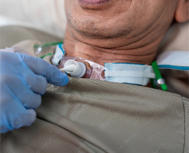 A man lying in a hospital bed with a medical tube inserted in his neck, appearing to receive treatment
